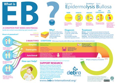 About the EB.